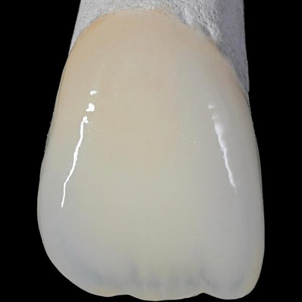 faccette dentali milano