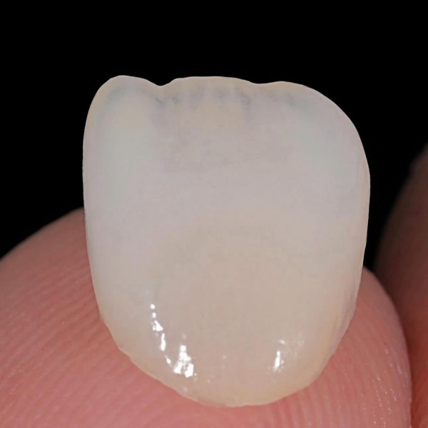 faccette dentali milano